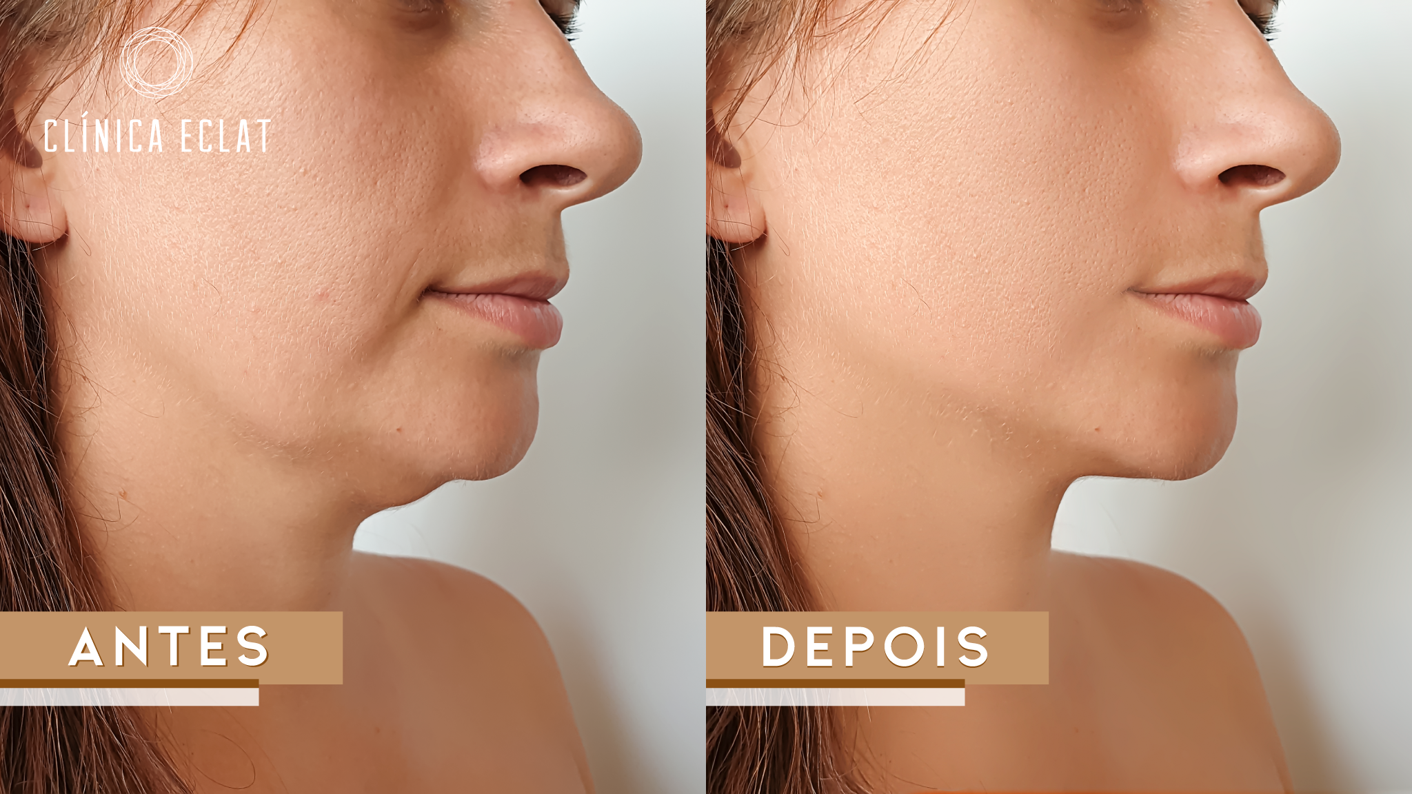 Facial Prime – Máscara de Rejuvenescimento Facial: Pele renovada e radiante!